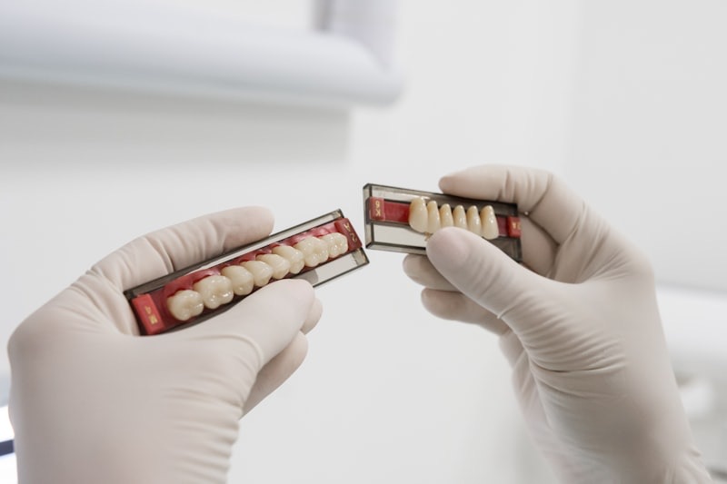 Crowns & Bridges at M Dental Greenwich