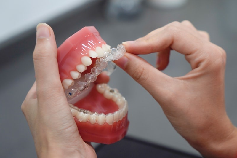 Invisalign at M Dental Canada Water