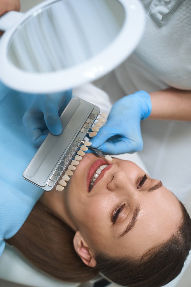Veneers at M Dental Greenwich